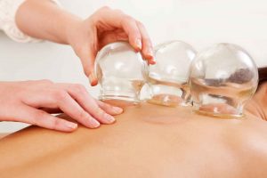cupping-massage-therapy-featured